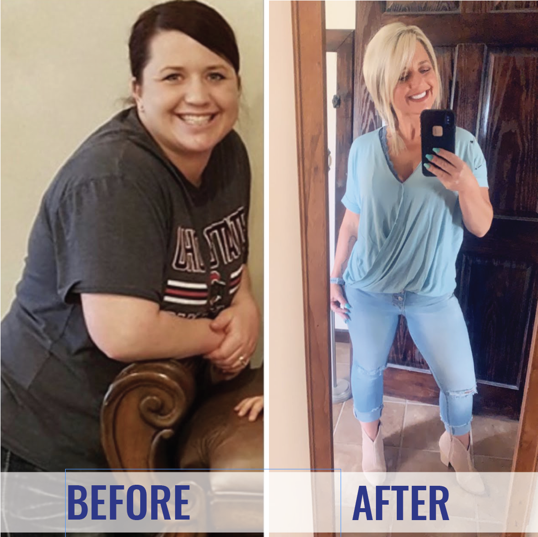 hcg weight loss